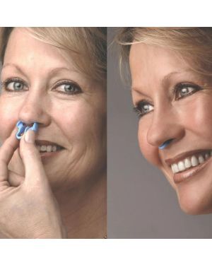 RespiraSoft™ - Silikon-Anti-Schnarch-Gerät (2er-Set)